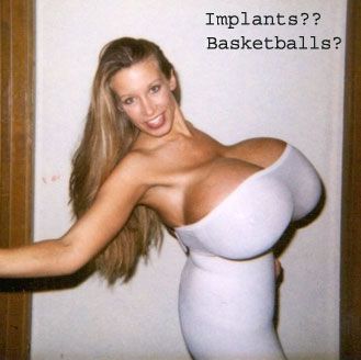 implants.jpg